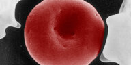Elektronenmikroskopische Aufnahme eine roten Blutkörperchens
